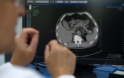 En China, la IA está detectando tumores mortales que los médicos podrían pasar por alto